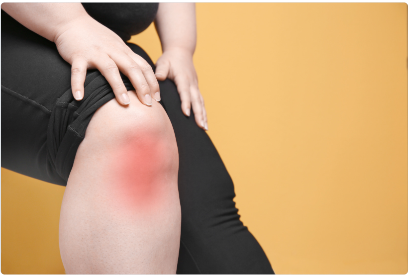 Rode, gezwollen knie