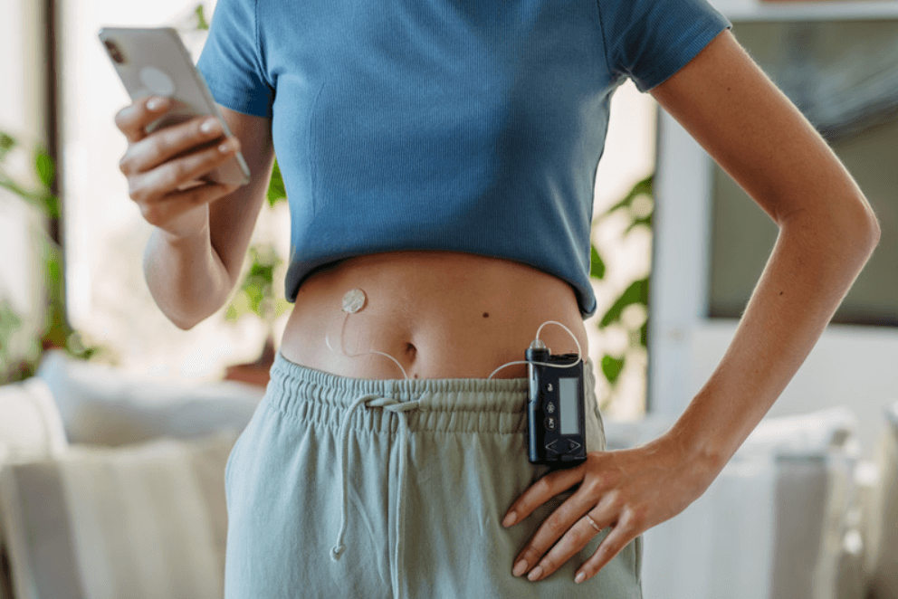 Insulinepomp diabetes