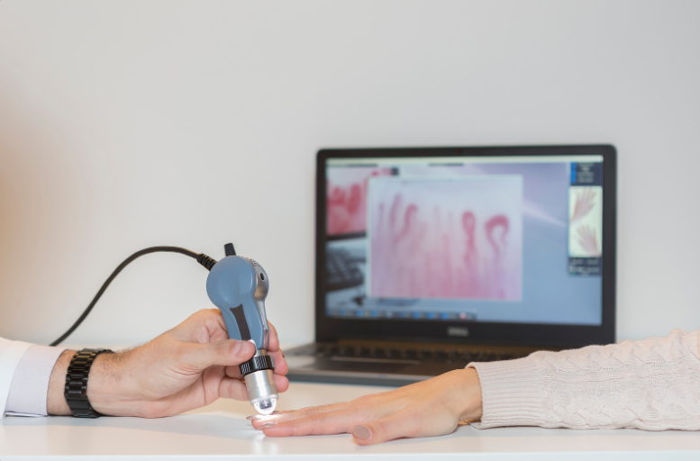Een arts onderzoekt de bloedvaten in de nagelriem van een patiënt.