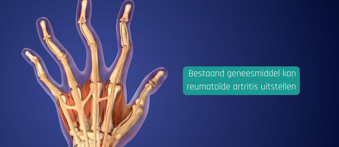 Существующий препарат может замедлить развитие ревматоидного артрита · Здоровье и наука