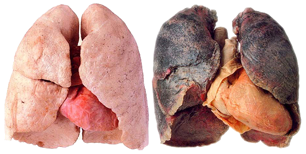 Kerstmis Quagga opstelling Kunnen je longen zich herstellen nadat je stopt met roken? · Gezondheid en  wetenschap